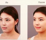 Пластическая хирургия и косметология в Южной Корее